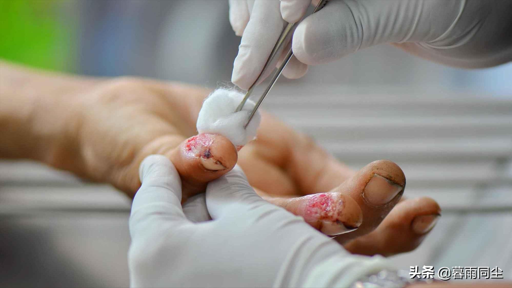 当你遭受核打击时,当受到伤害攻击该如何应对