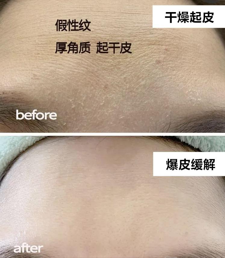 脸泛红是洗面奶的原因吗,为什么用完洗面奶脸会变白