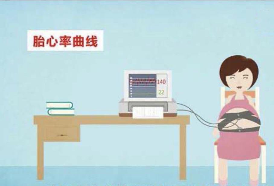 惠民二院胎心监护,胎心监护室的宣教内容