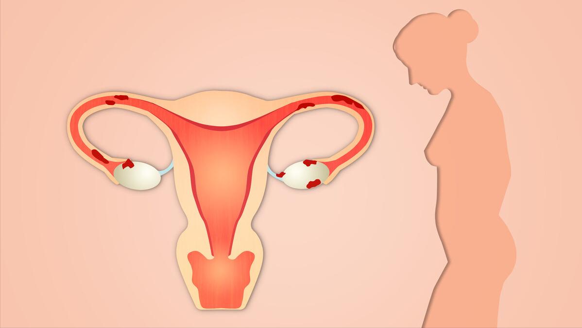 意外怀孕多久做无痛人流手术,怀孕36天无痛人流真实经历