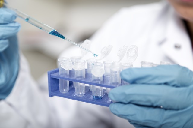 her2阳性乳腺癌新辅助化疗指南,乳腺癌病人基因检测报告her2扩增