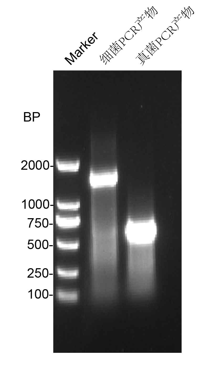 16srdna测序,16rns测序结果分析