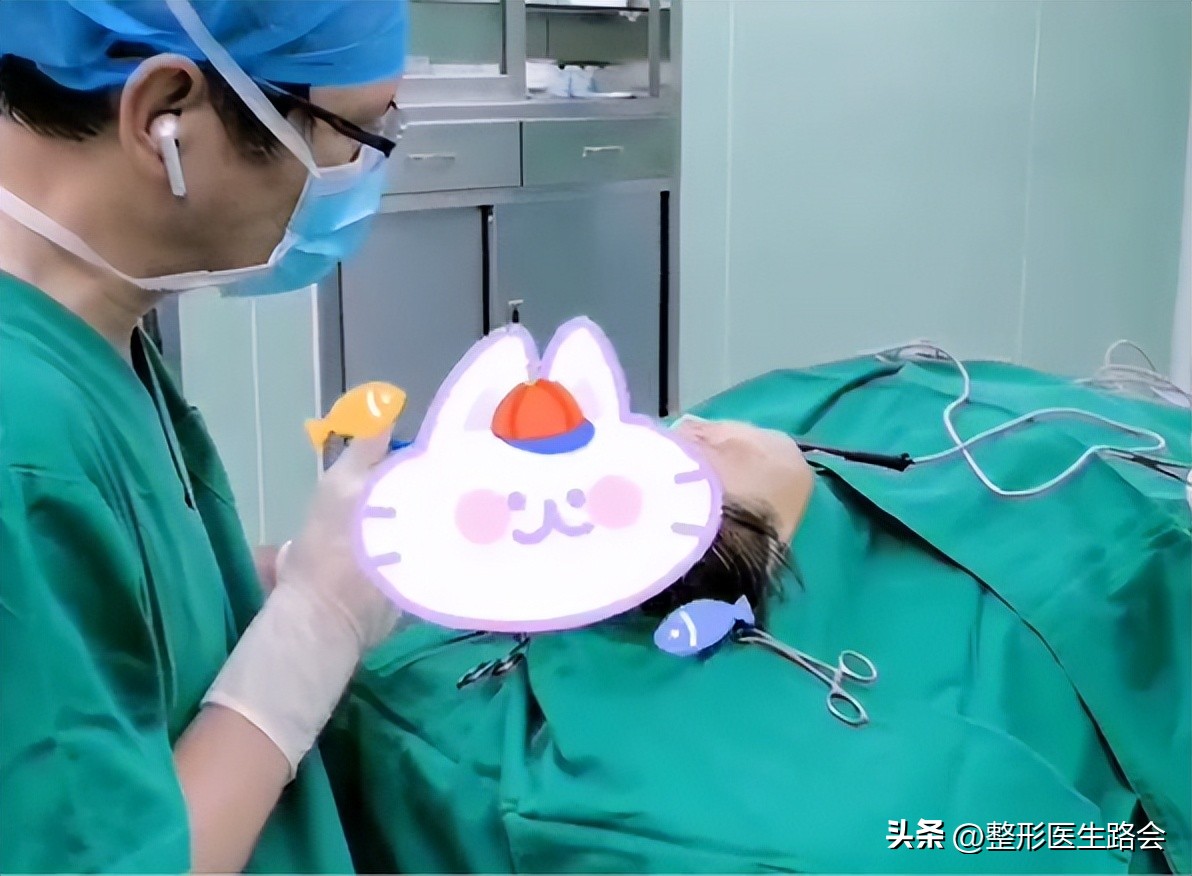 上海九院膨体填充太阳穴费用多少,膨体丰太阳穴视频全过程