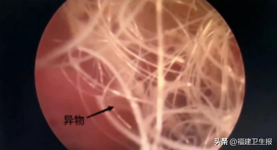 6岁小女孩出血怎么回事,六岁女童无缘无故流血