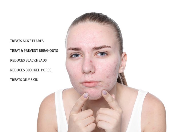 16岁儿童脸上长疮怎么办,16岁长痤疮怎么办