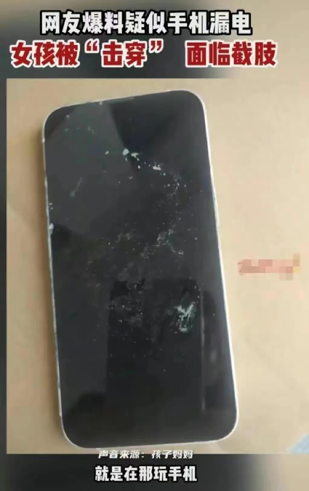 被电击女孩因脏器受损面临截肢,女孩充电时玩手机被电击面临截肢