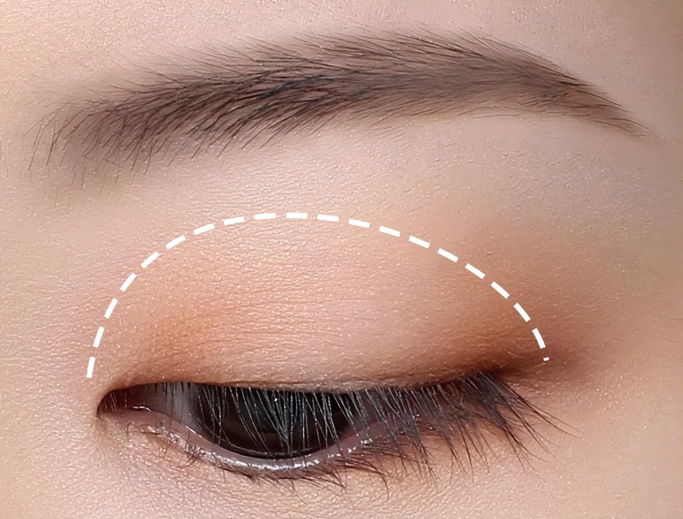 单眼皮肿眼泡如何不贴双眼皮消肿,单眼皮肿眼泡怎么消肿最快