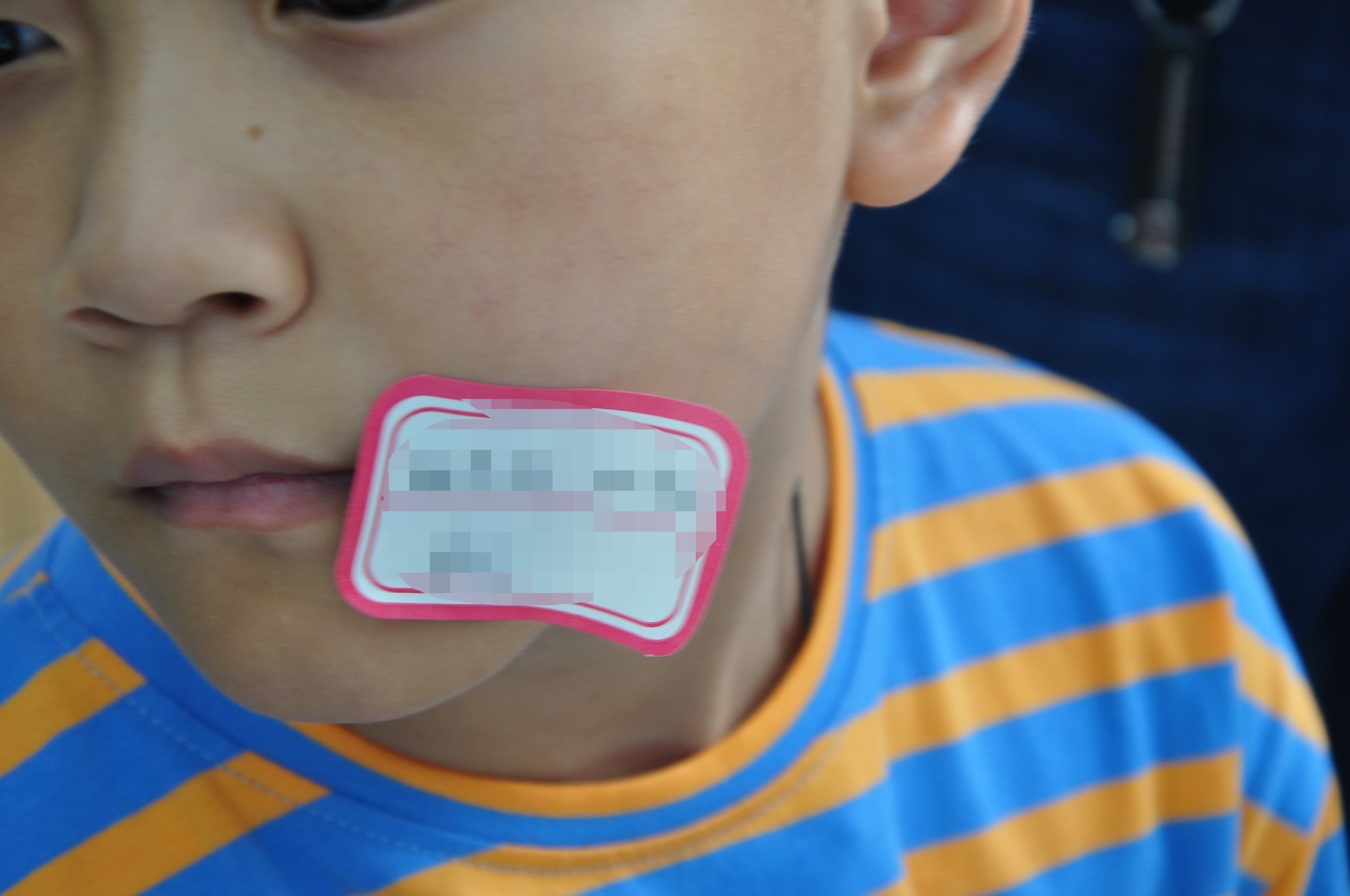 郑州市第二中医院祛疤痕怎样,郑州第二中医院疤痕修复怎么样