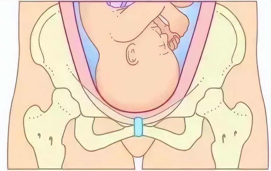 产后盆底肌如何修复,产后盆底肌受损如何科学恢复