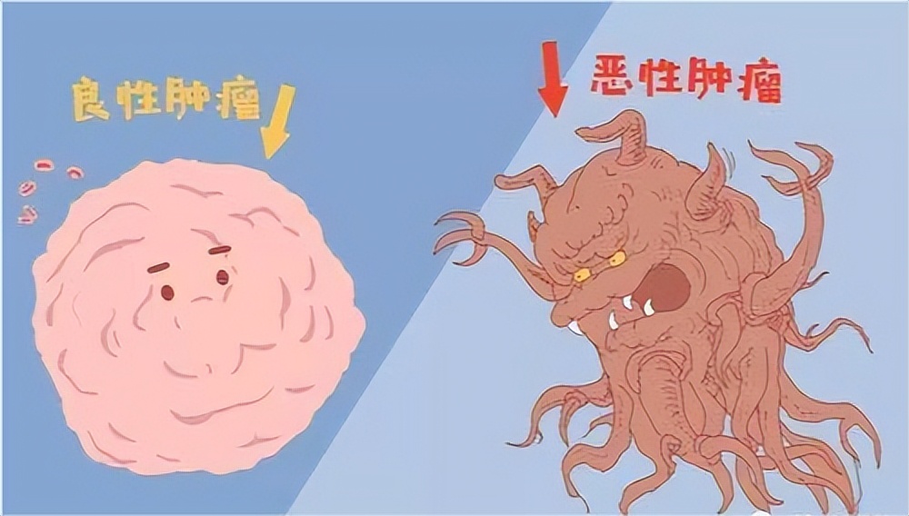 感染艾滋病毒后，你还能活多久？