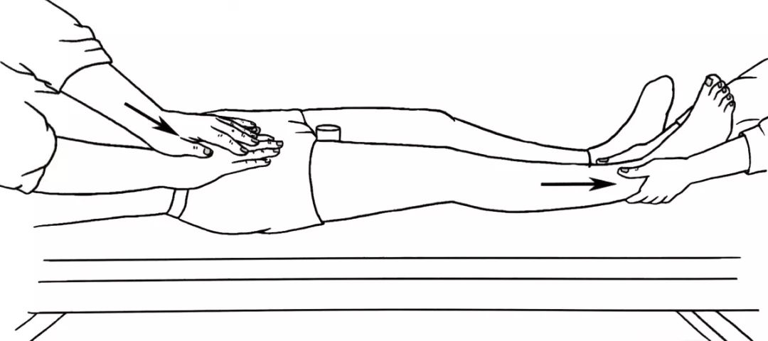 关节脱位的手法复位术操作步骤,关节脱位的手法复位