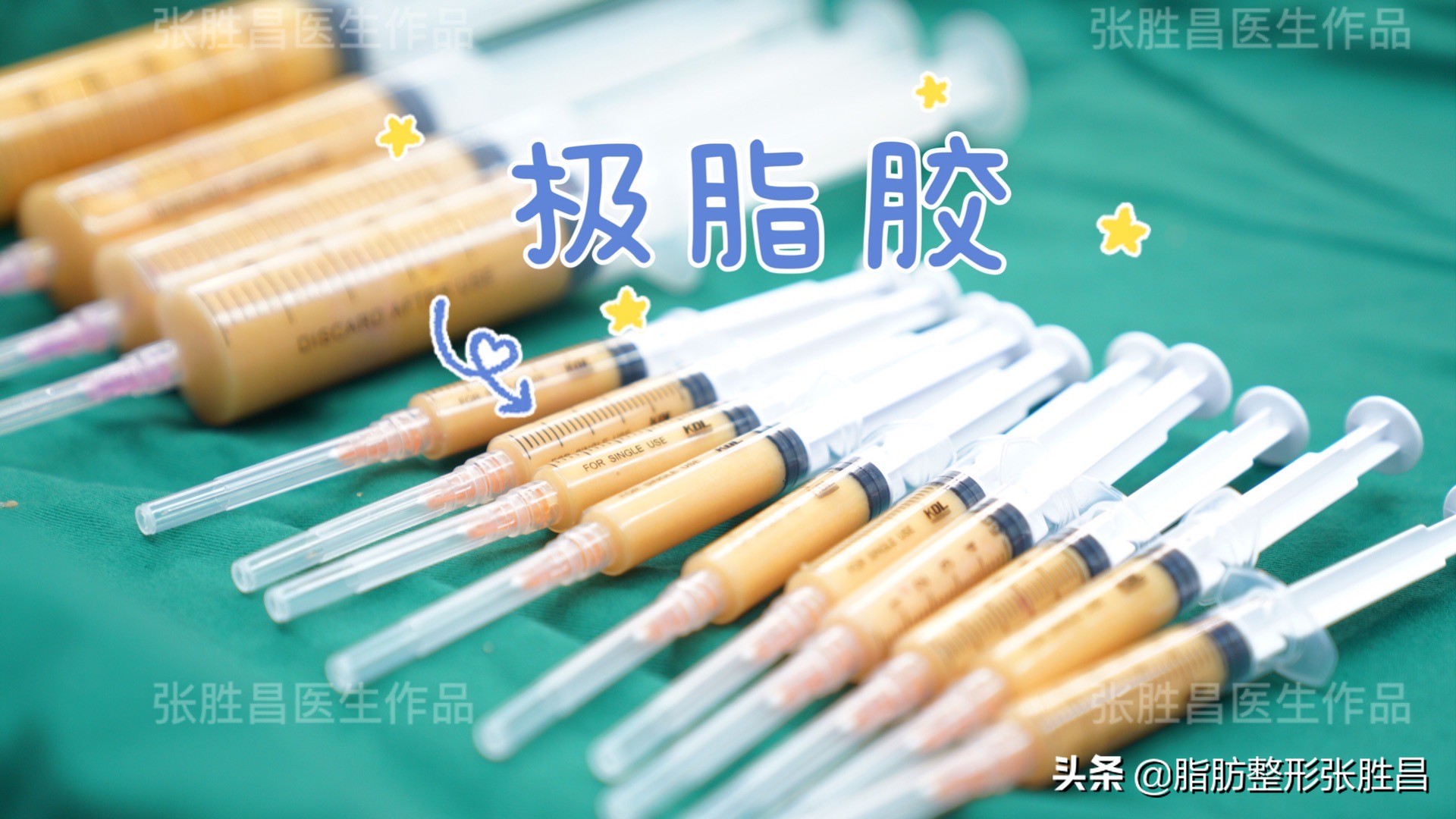 脂肪填充的真相,你不可不知道的面部脂肪填充真相