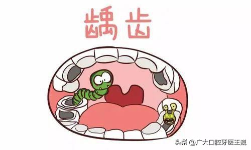 儿童蛀牙牙痛补牙还是根管治疗好,蛀牙烂空了是种植好还是治疗好