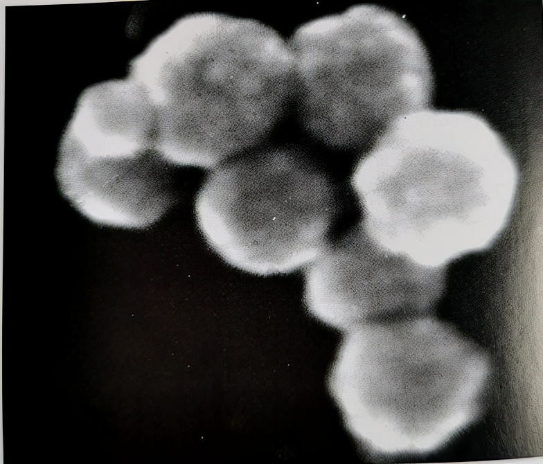 uu感染会自愈么,uu感染是hiv吗