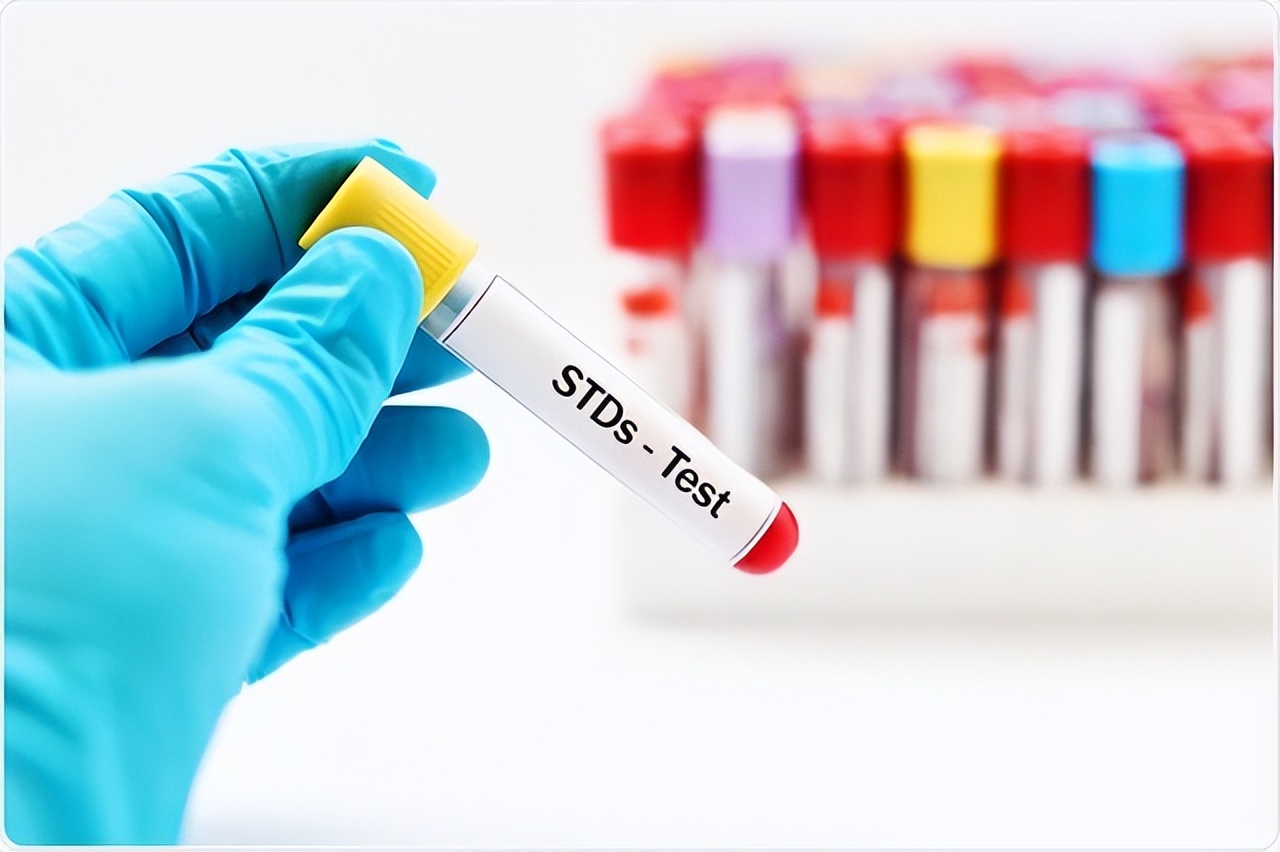 感染性传播疾病的症状,常见性传播疾病症状