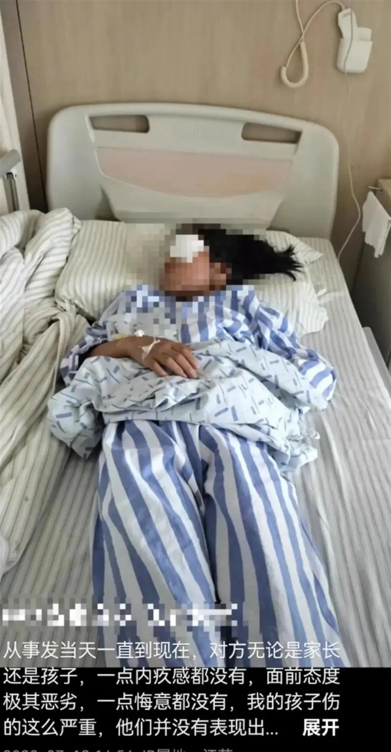 女孩被男孩用弹弓打失明,女孩眼睛被男孩打中