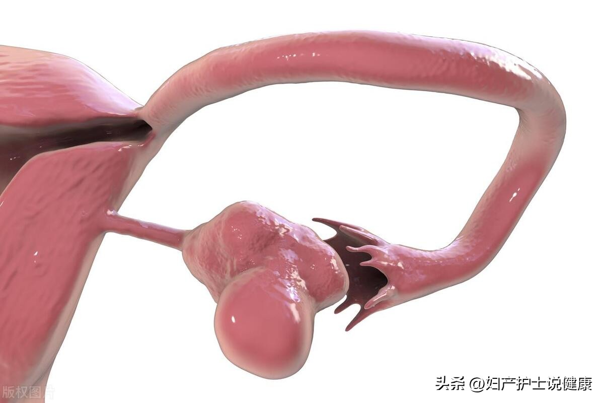 女性持续腹痛发热,使用抗生素会引起不孕不育症吗