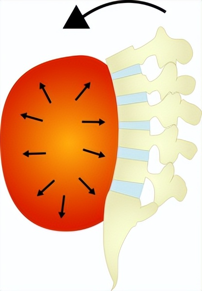 深蹲注意事项及危害,深蹲总是弯腰怎么康复