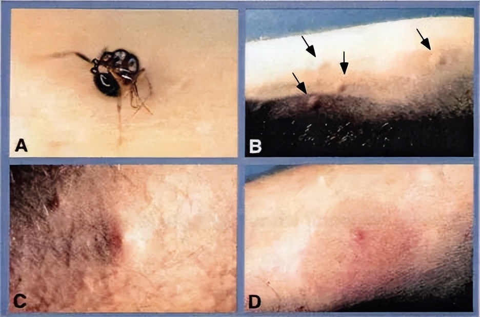 小宝宝出门怎么防护毒虫,带孩子出去玩当心这种虫子