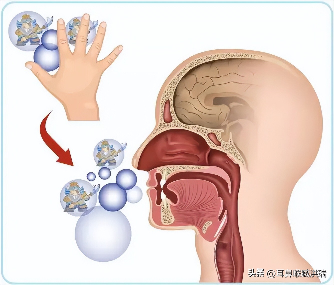 捏鼻子让鼻子变大了该怎么恢复,捏了一年鼻头的变化