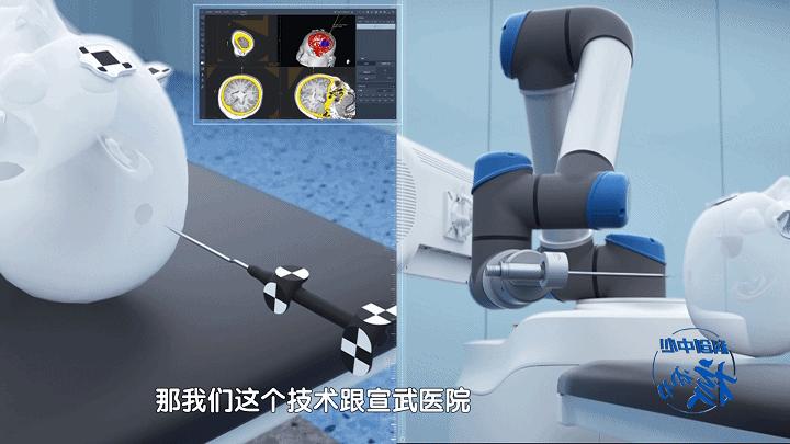 科创中心“核”动力|柏惠维康：外科医生的智慧“手、眼”