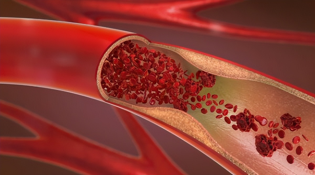 口服阿司匹林肠溶片需要注意什么,阿司匹林与阿托伐他汀钙吃多久