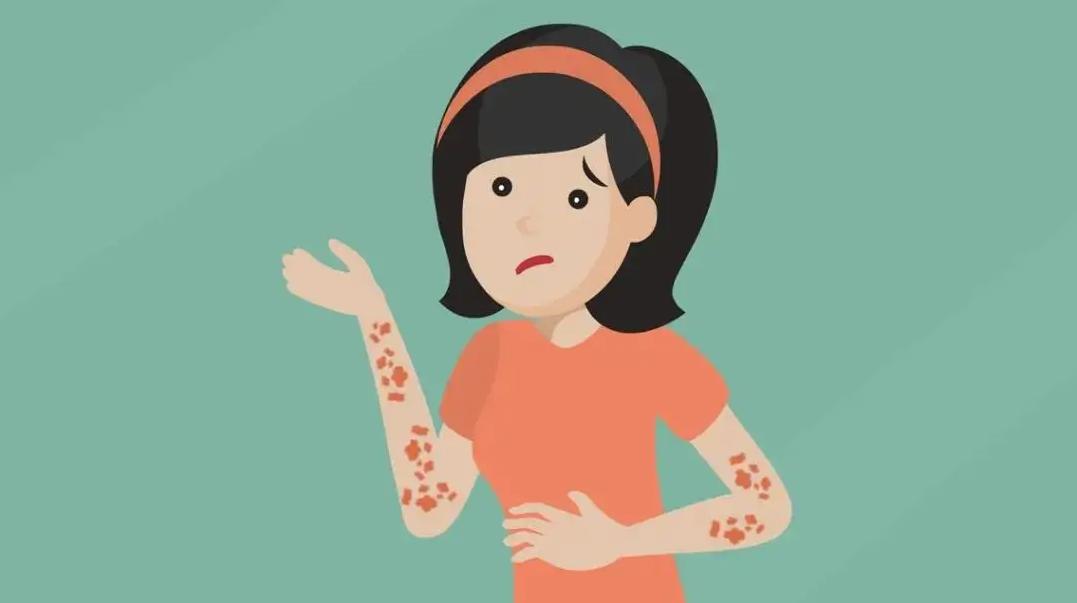 中医治疗带状疱疹特效药,中医是如何治疗带状疱疹的