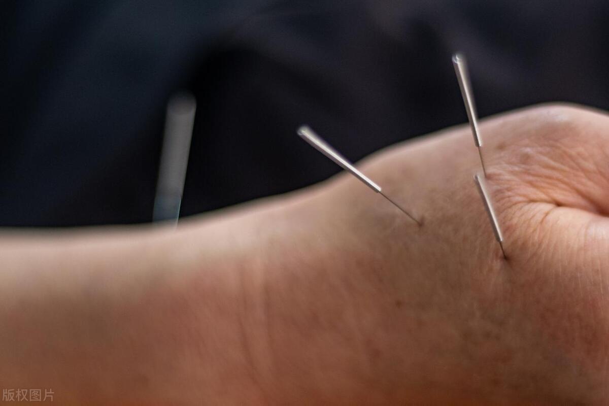 大专的中医康复技术有哪些课程,大专中医理疗康复