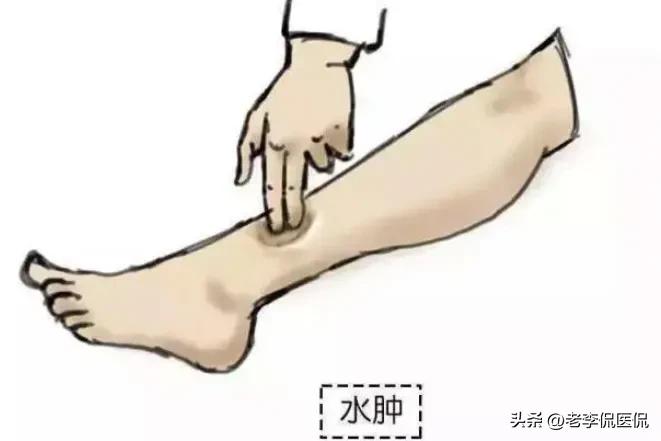 肾气足百病除,肾气足百病除下一句