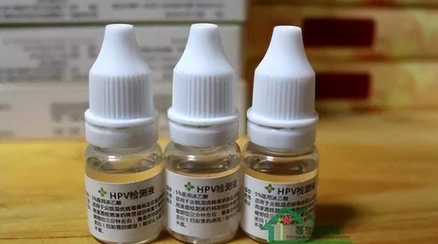 尖锐性湿疣可以用食用白醋检测吗,食用白醋能做湿疣醋酸白试验吗