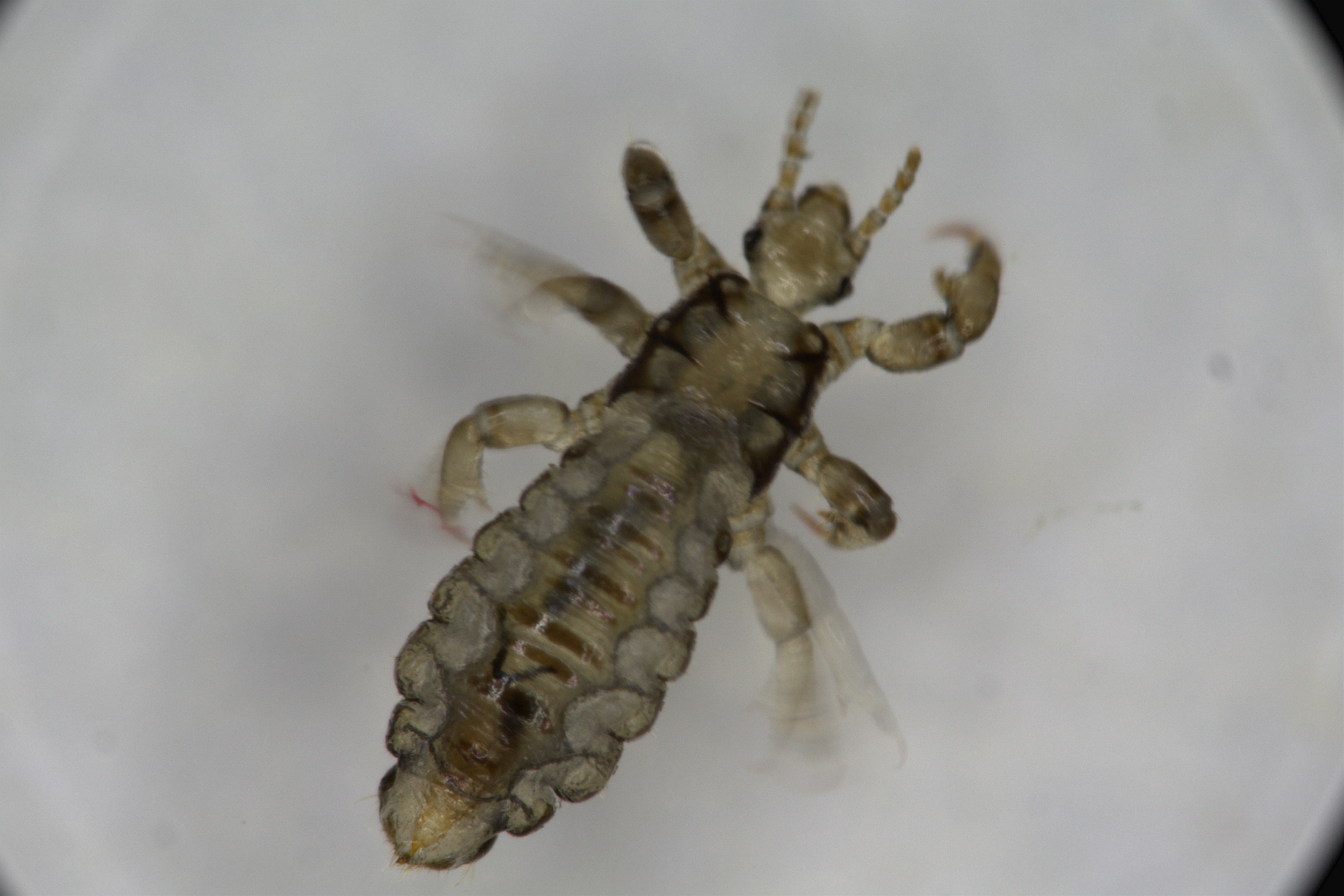 七岁孩子头发上怎么长虱子,小孩头发长头屑虱子