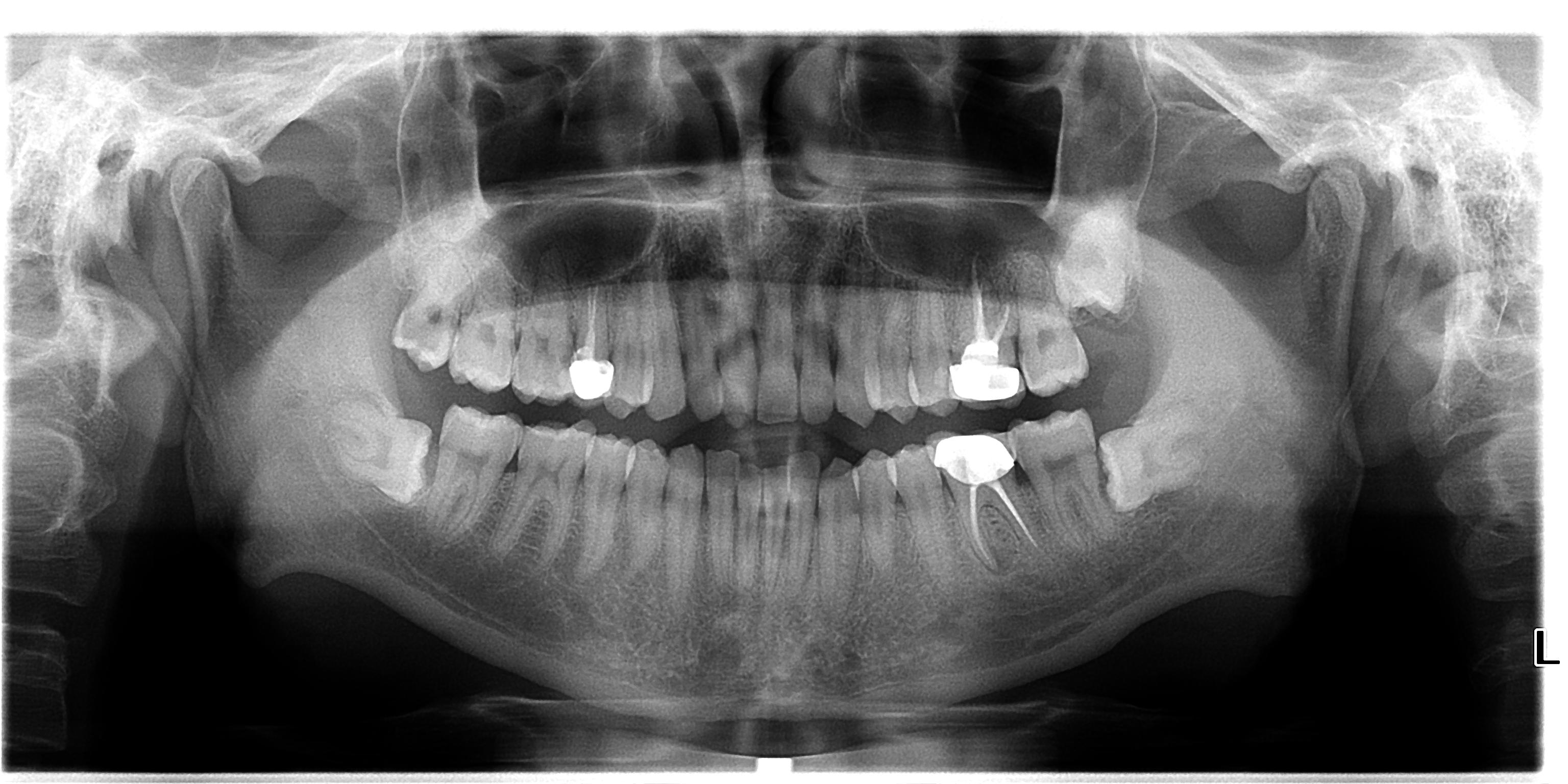 德国卡瓦全景机多少钱,德国卡瓦口腔设备