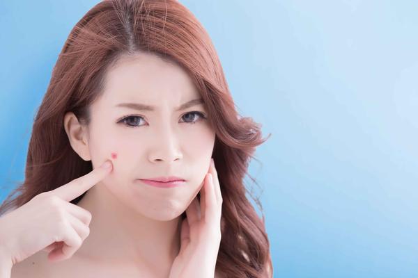 脸上长痘痘怎么办最简单的方法,脸上长痘痘这几招轻松解决