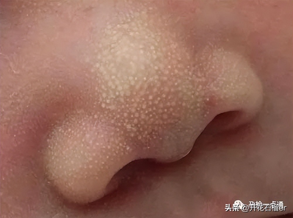 新生儿这28个异常表现都是正常的,新生儿值得注意的各种症状