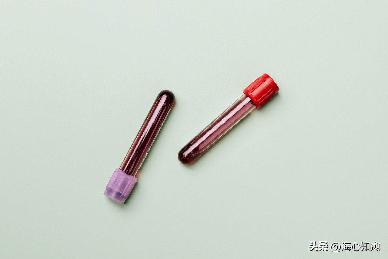 放疗有这么多危害为什么还要做呢,放疗期间的饮食要注意哪些事项