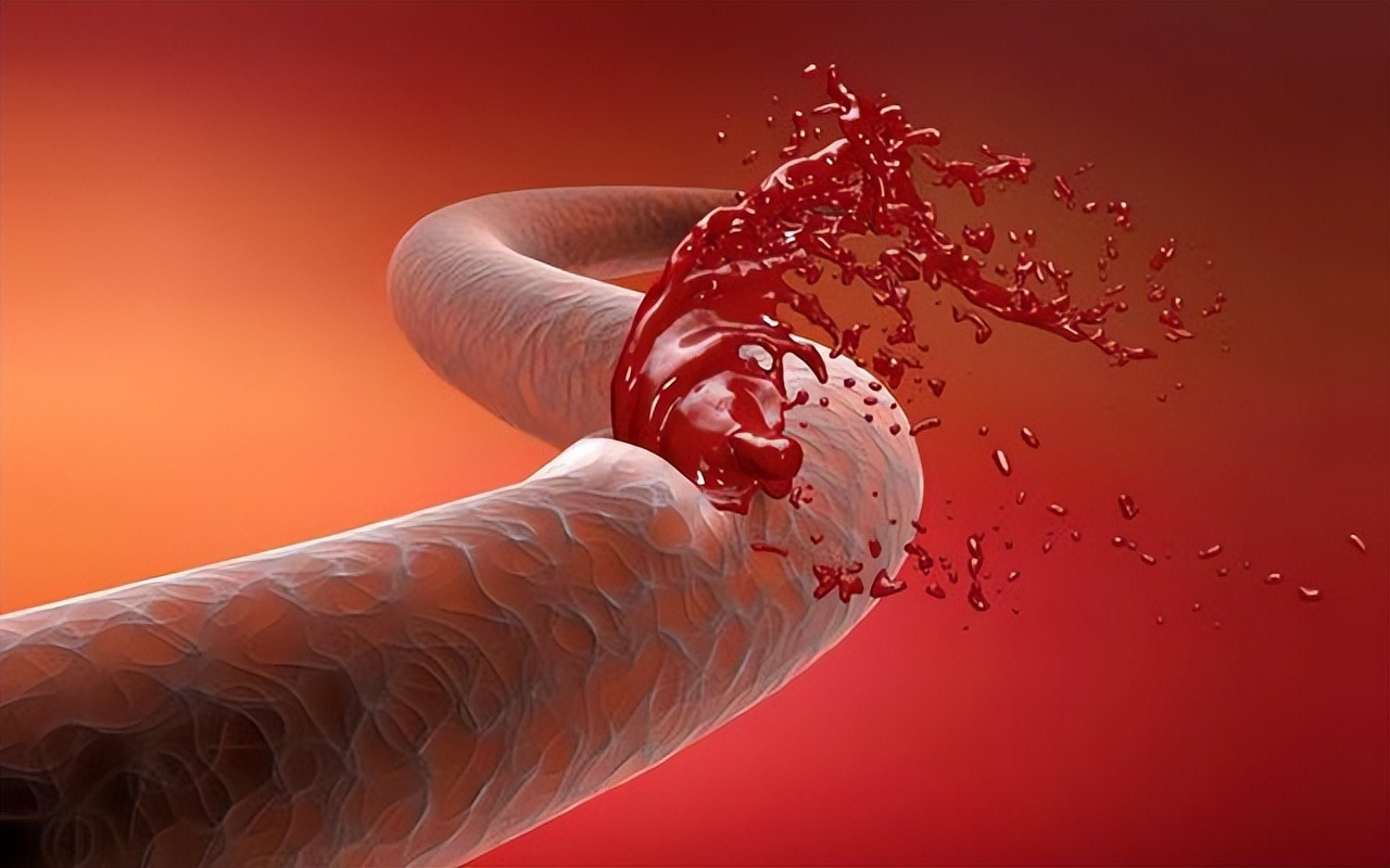 妻子和丈夫同房，被丈夫“种草莓”，第二天匆匆赶到医院，为何？