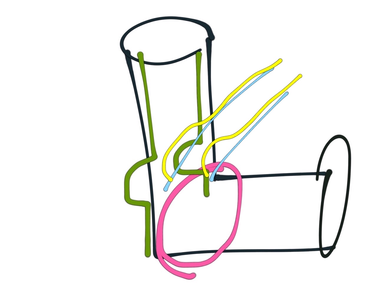 瑜伽里如何正确的弓背,瑜伽解决脊柱侧弯体式