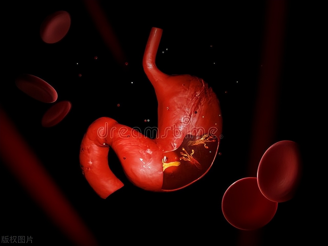 浅表性胃炎吃什么药不损害胃,浅表性胃炎需要重视吗