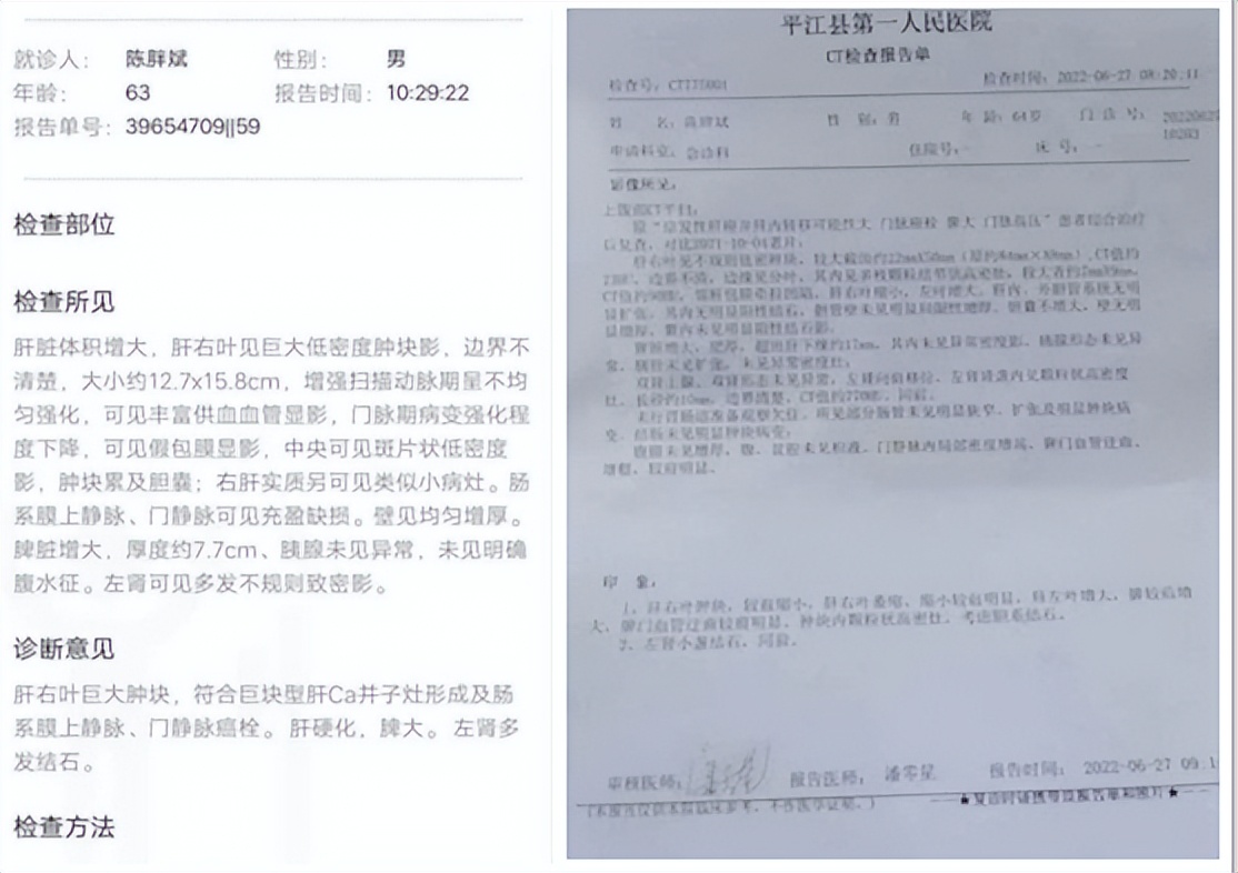 陈海林治疗癌症,陈海林肿瘤名医