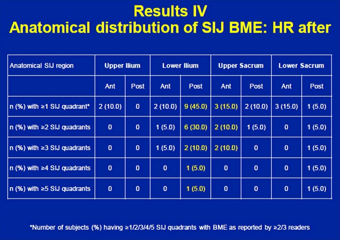 骶髂关节骨髓水肿最好的治疗方案,骶髂关节水肿是强直性脊柱炎吗