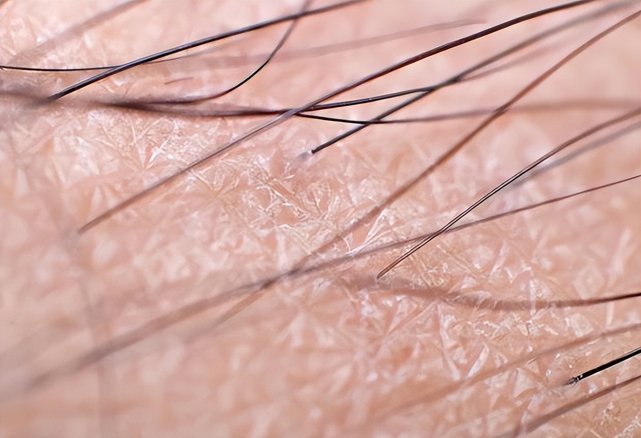 阴毛变白是身体生病了吗？