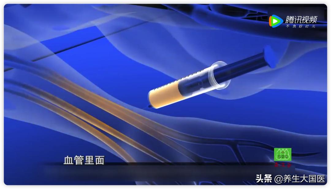 多发性骨转移疼痛最好的止疼方法,骨转移疼痛一招搞定