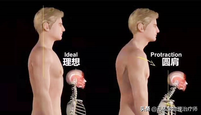 肩膀肌肉紧绷怎么放松,肩膀僵硬不放松怎么办