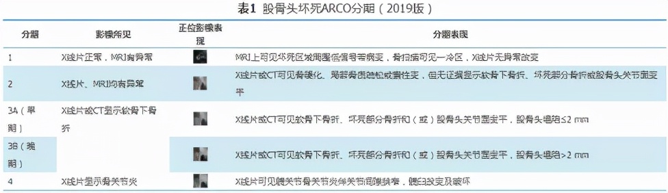 木豆二仙汤能治疗股骨头坏死,山东股骨头坏死治疗医院排名