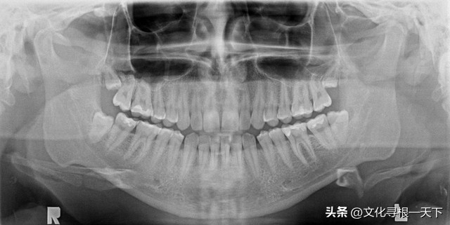 看牙记录视频大全,看牙记作文200字