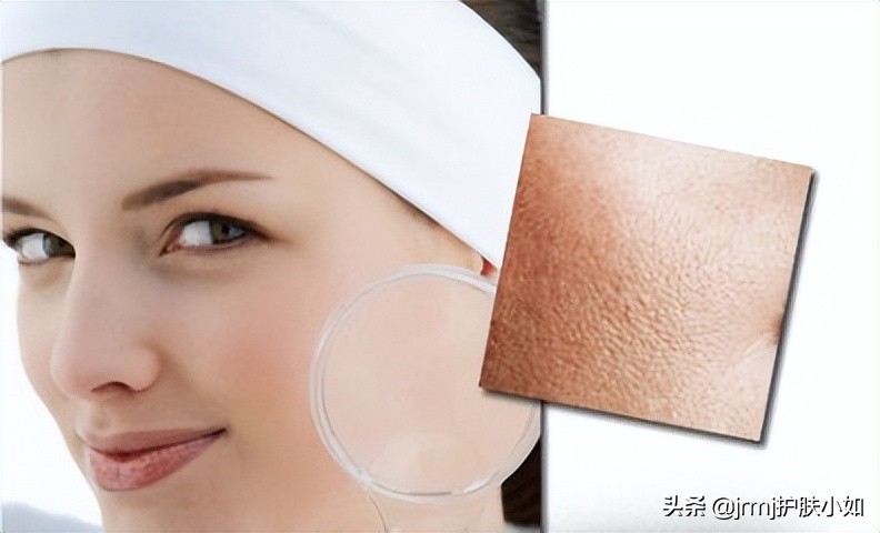 毛孔粗大收缩毛孔做什么医美项目,医美收缩毛孔能达到什么效果