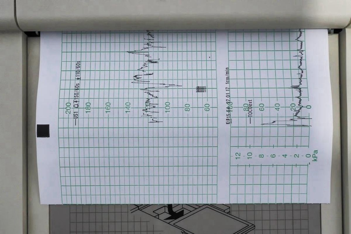 胎心辨别宝宝性格,通过胎心率可以判断宝宝的胎位