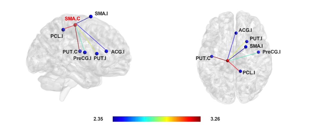 世界帕金森病日第28个主题,世界帕金森病日完整版