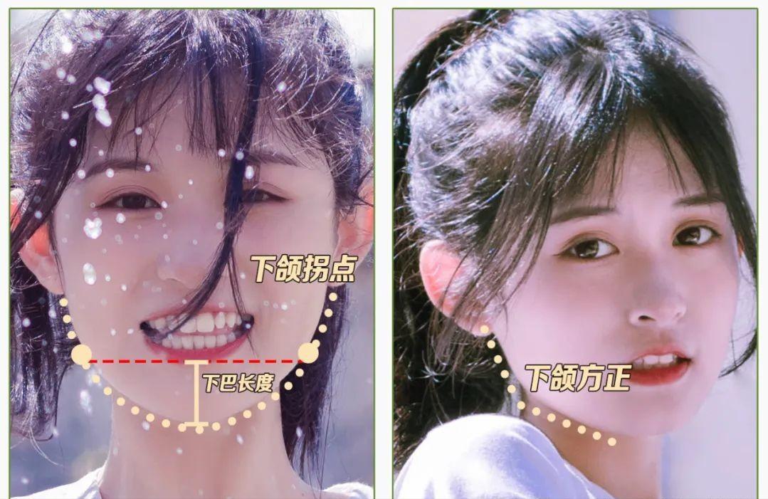 方圆脸秒变高级脸的方法,方圆脸怎么让脸型变得流畅医美