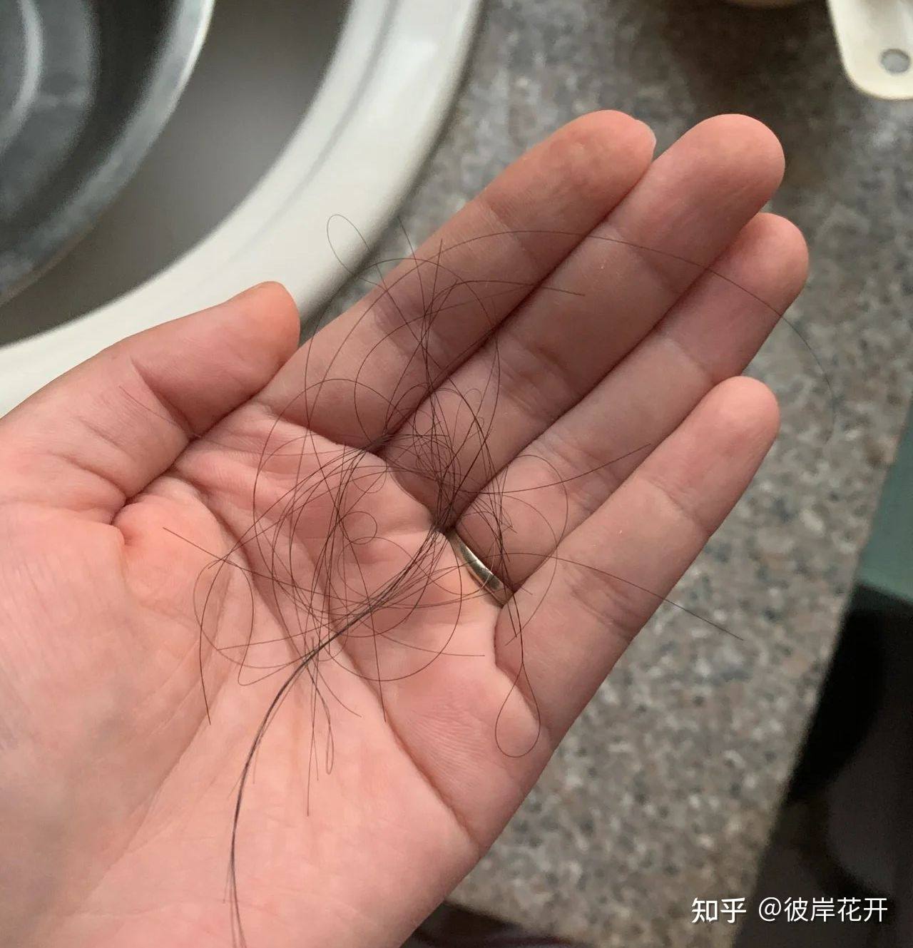 怀孕后用什么洗发露防掉发,怀孕后头发特别油是怎么回事